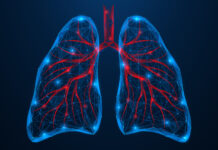 Brensocatib Effectiveness Similar for Bronchiectasis With and Without Eosinophilia