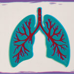 Analysis Shows Effectiveness of Brensocatib in Adolescents With Bronchiectasis