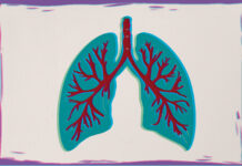 Analysis Shows Effectiveness of Brensocatib in Adolescents With Bronchiectasis