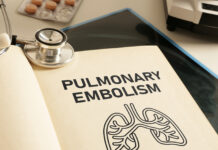 Timing of Pulmonary Embolism Response May Impact Access to Specialists